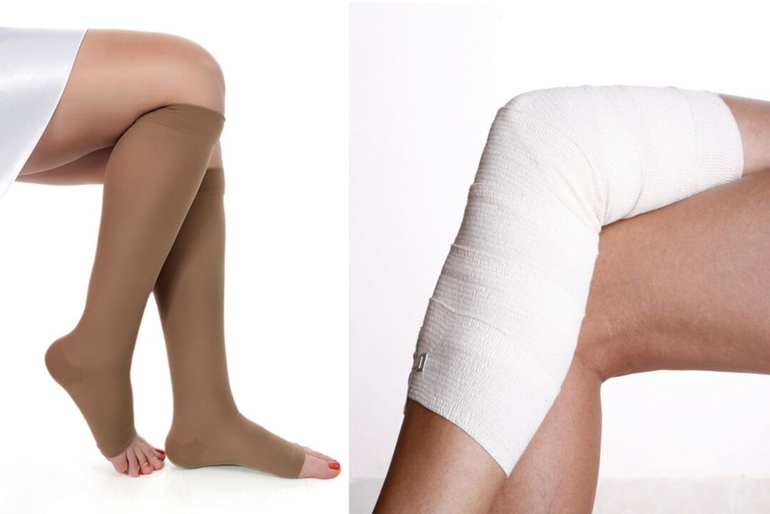 How to treat varicose veins
