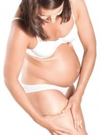 Varicose veins during pregnancy