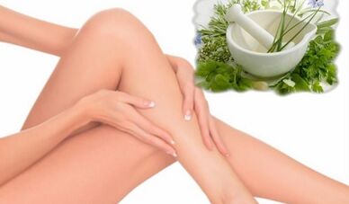 Treatment of varicose veins in the lower limbs through folk therapy