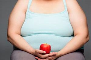 To heal varicose veins, you need to lose excess weight