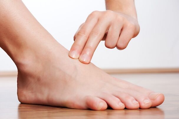 No varicose veins in legs after laser treatment