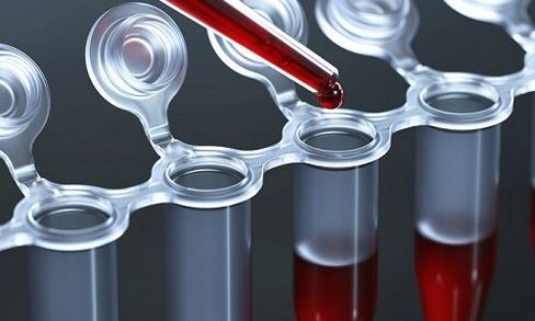 Blood test for varicose veins in the legs