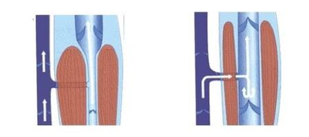 Normal operation of intravenous pump