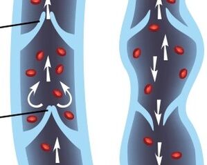 Operation of lower extremity venous valve devices