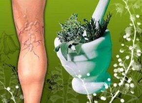 Traditional medicine against varicose veins of the lower extremities